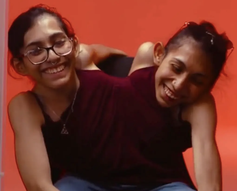 Conjoined twins reveal one is asexual while the other has a boyfriend