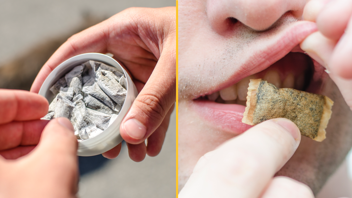 Dentist shows devastating things that snus can do to your teeth