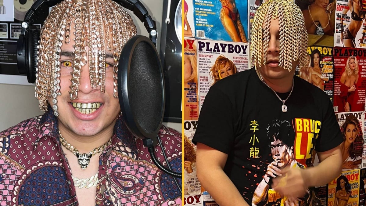 Handbag Head Rapper Rapper gets gold chain hooks surgically implanted into his head